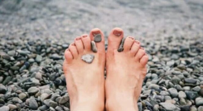 
					Tips Atasi Telapak Kaki yang Pecah-pecah