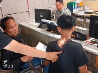 Remaja berinsial DT saat menunjukkan bekas penusukan oleh terlapor M usai melaporkan kejadi ke SPKT Polrestabes Palembang. Foto : Istimewa
