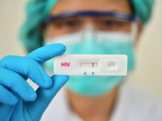 Positif virus HIV. Foto : Istock