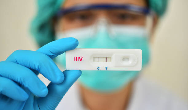 Positif virus HIV. Foto : Istock